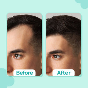 https://cdn.shopify.com/s/files/1/0888/8057/8807/files/peptide-serum-cell-hair-growth-5-before-_-after.jpg?v=1758287021